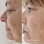 Sublime Peau Anti-age